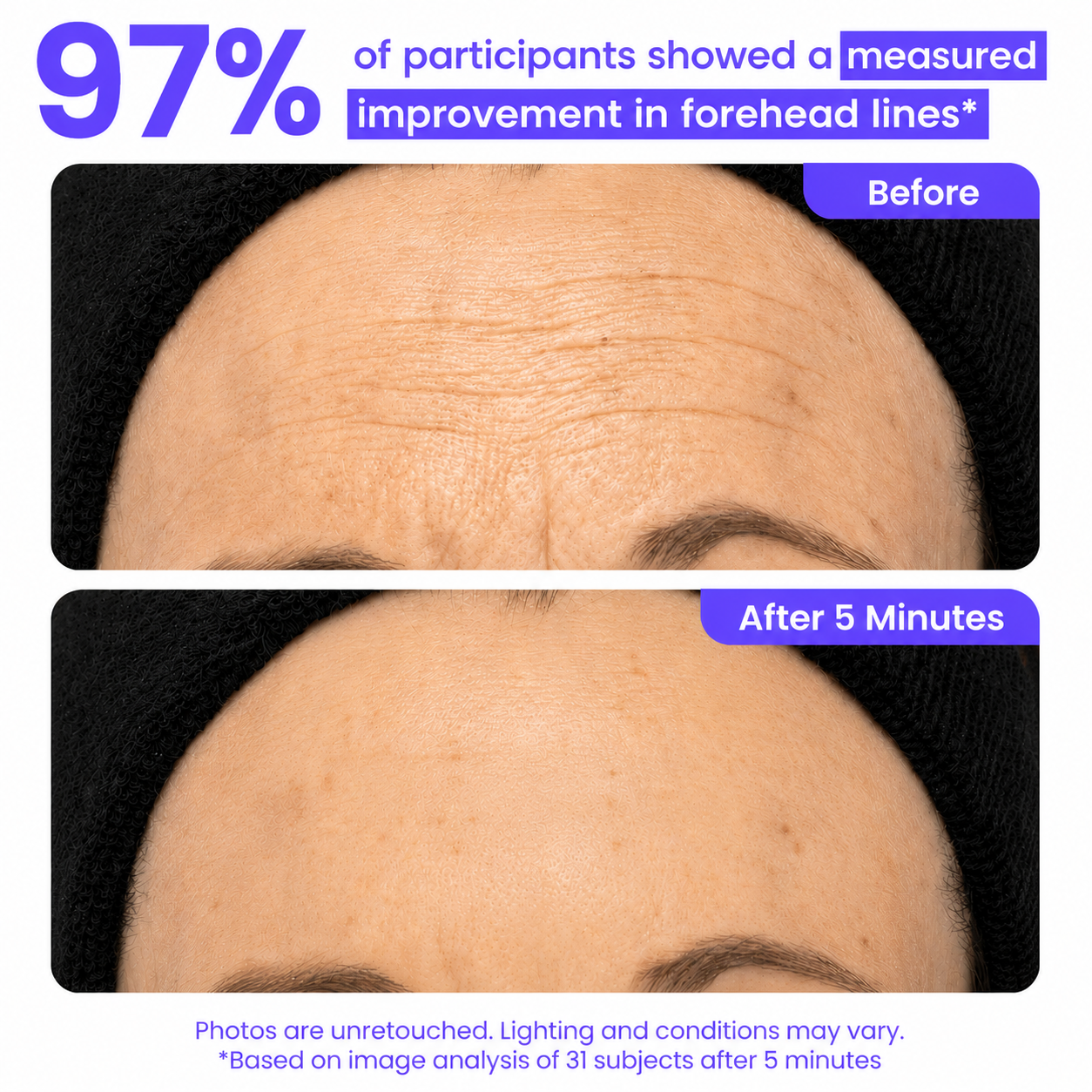 Viareline™ Instant Lift Eye Cream