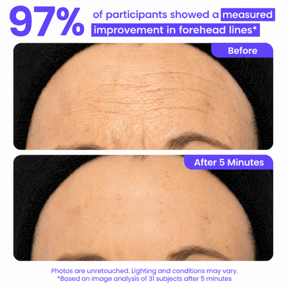 Viareline™ Instant Lift Eye Cream